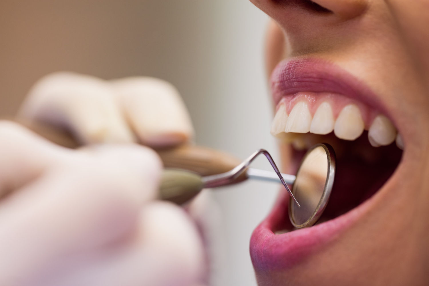 rcp dentiste